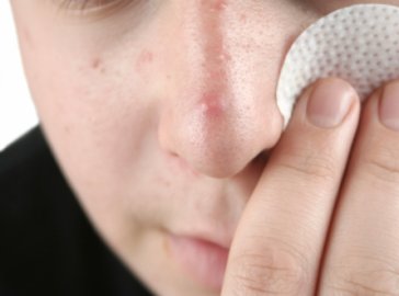 Photo of young man cleansing his skin