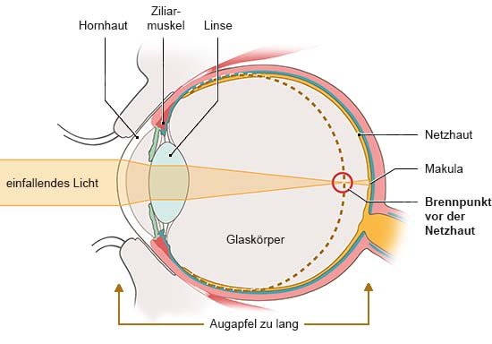 Grafik: Anatomische Darstellung eines Auges in Seitenansicht