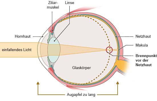 Grafik: Anatomische Darstellung eines Auges in Seitenansicht