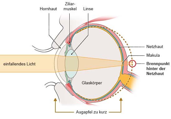 Grafik: Anatomische Darstellung eines Auges in Seitenansicht